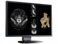 Barco Nio Fusion 4MP 30" Color DuoView Medical Display MDC 4130