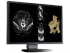 Barco Nio Fusion 4MP 30" Color DuoView Medical Display MDC 4130