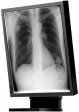 Siemens SMD 18102 G - 1 Megapixel Grayscale 18" Medical Display